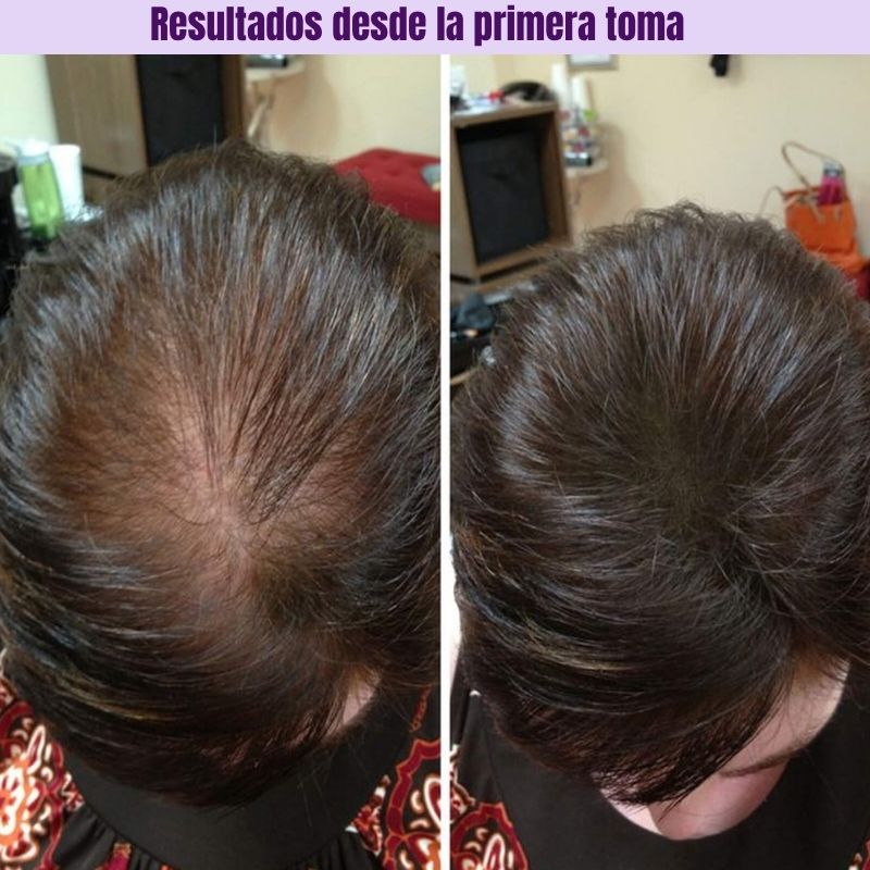 HAIR GROWTH 🌸 Vitaminas para el Crecimiento del Cabello para Mujeres